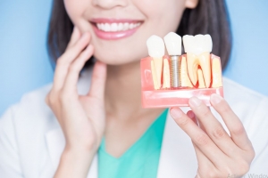 Key Considerations When Choosing an Implant Dentistry Course Key Considerations When Choosing an Implant Dentistry Course